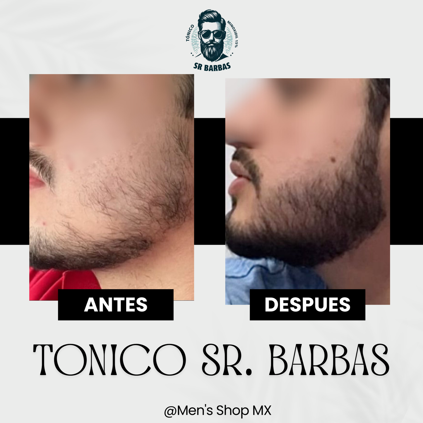 Tratamiento Intensivo de Barba (2 Meses)