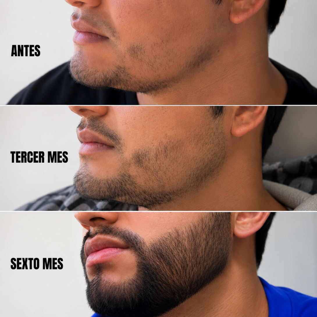 Tónico Sr. Barbas