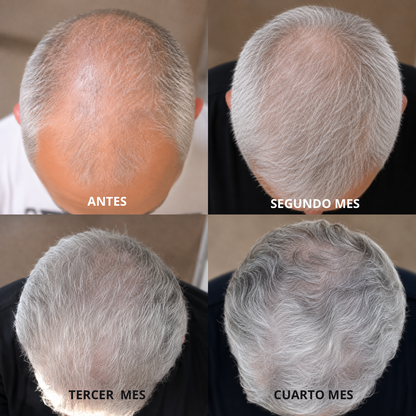 Tónico Sr. Barbas