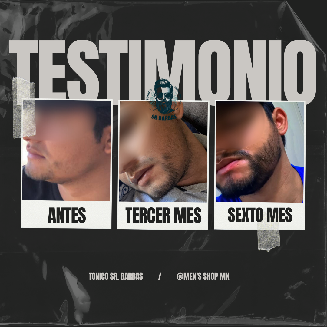 Tratamiento Intensivo de Barba (2 Meses)