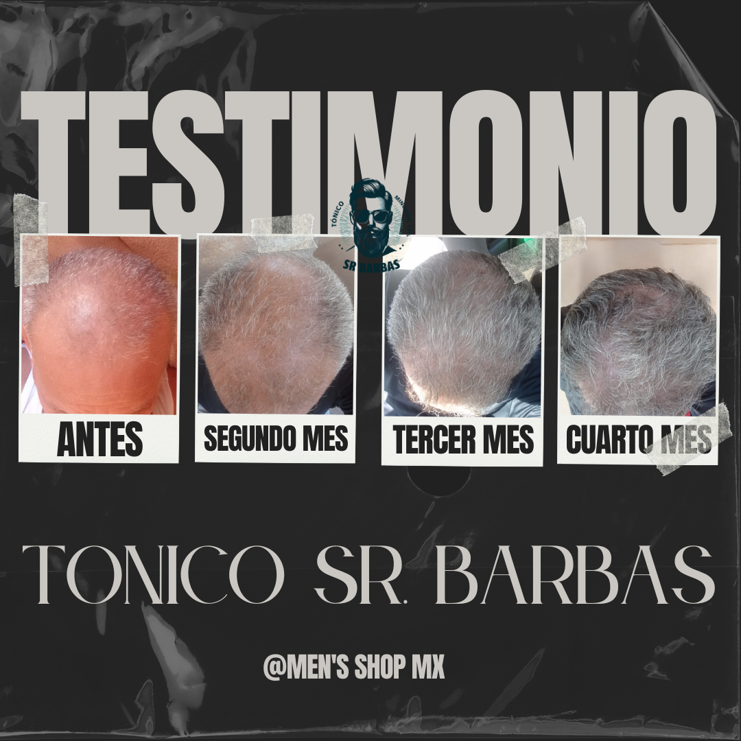 Tratamiento Intensivo de Barba (2 Meses)